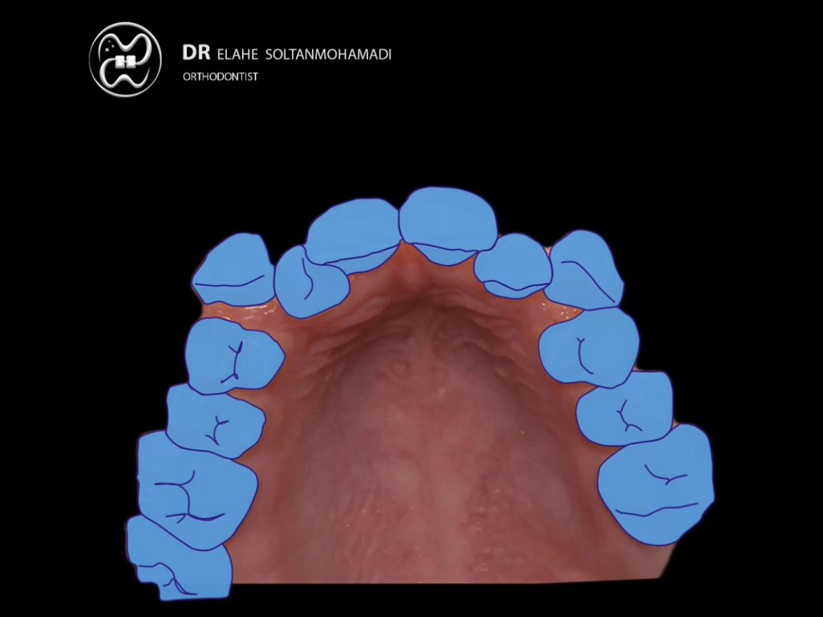  درمان ارتودنسی در یک نگاه